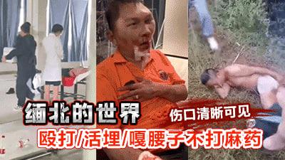 【真正缅北】殴打打活埋关子电击杀人每天都在发生成为缅北猪仔真的是活成了畜生人命比狗贱