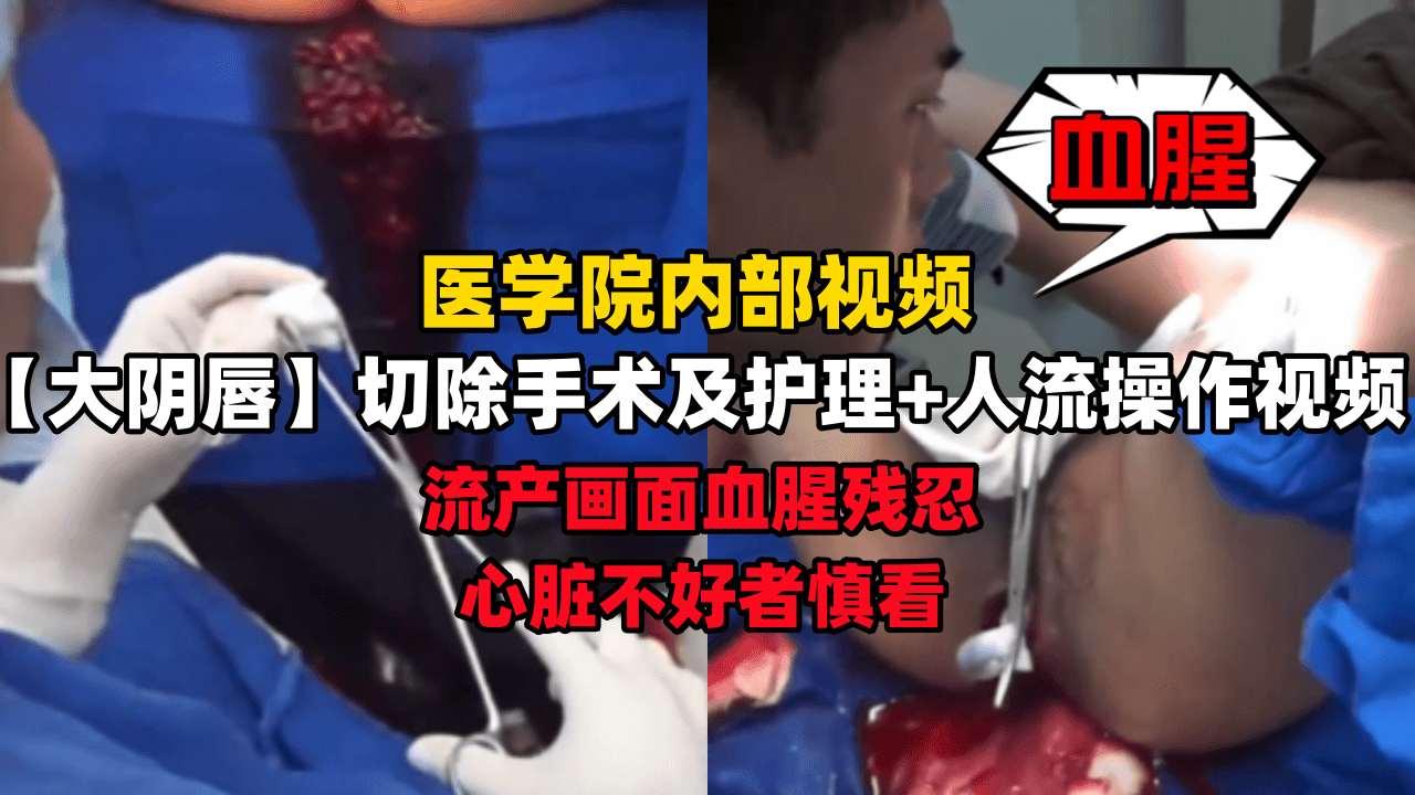 【绝密医院内部视频】大阴唇切除手术及护理+人流操作视频流产画面血腥残忍心脏不好者慎看